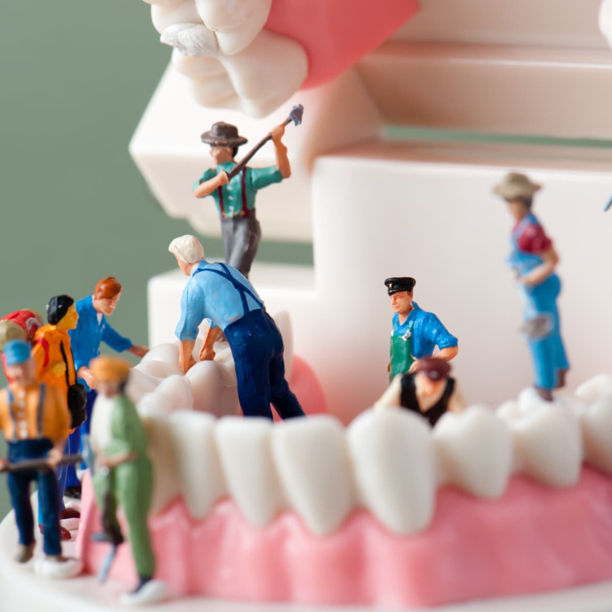 Removing Mercury Fillings Safely Smiles By Bis