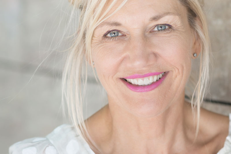 Dental Porcelain Veneers Smile Makeover Treatment Oakville | Dr. Agatha Bis | Smiles by Bis