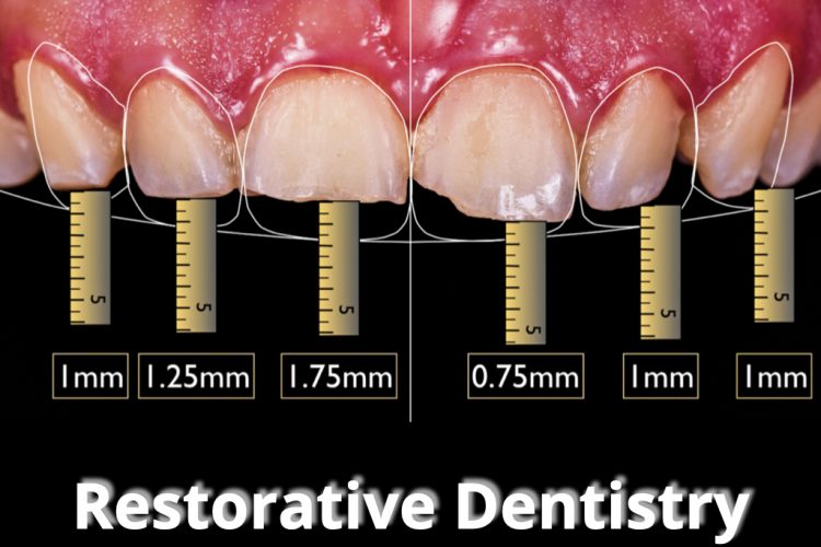 Restorative Dentistry | Dr. Agatha Bis