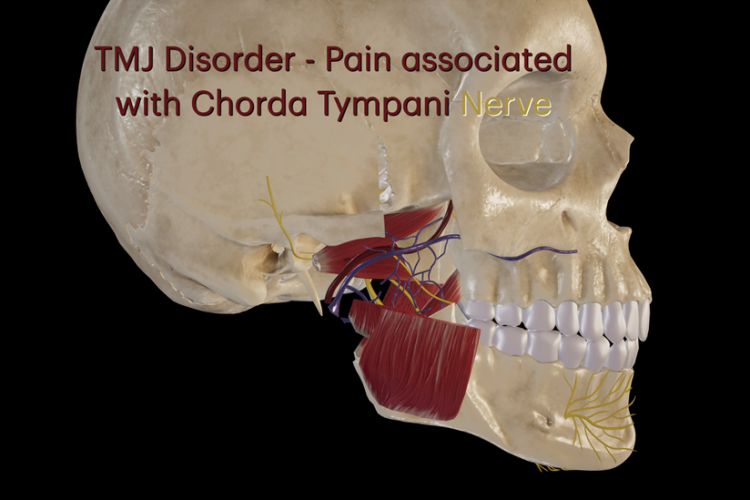 TMJ Disorder - Nerve Pain Chorda Tympani