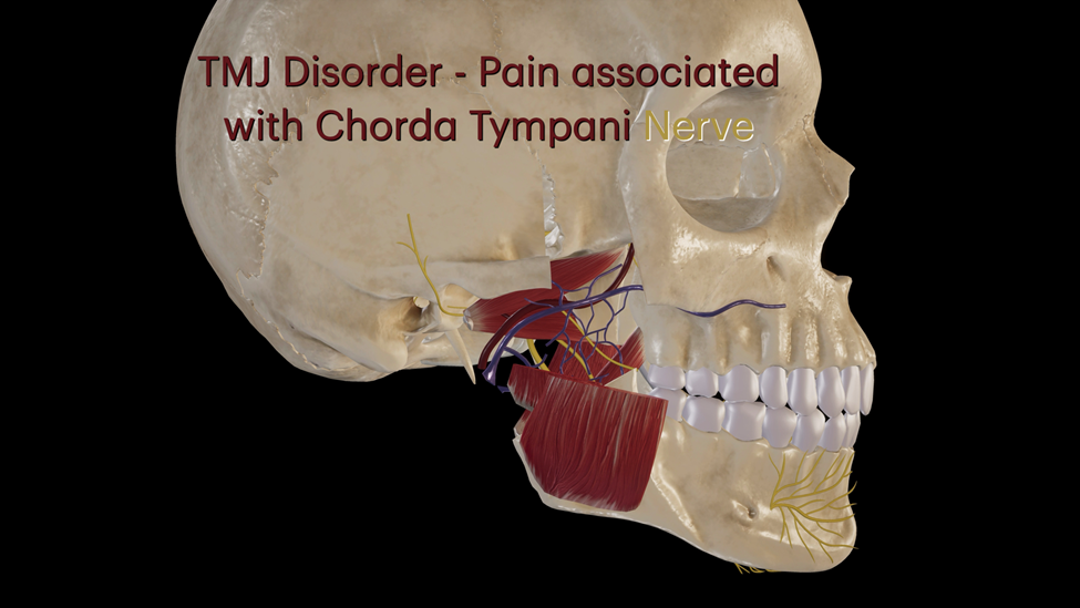 TMJ Disorder - Nerve Pain Chorda Tympani