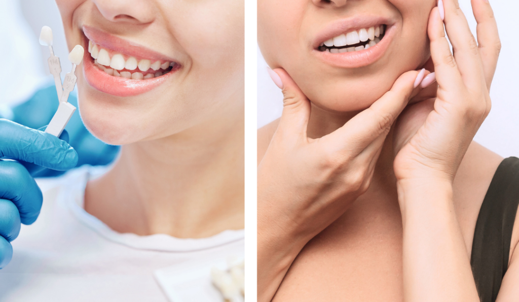Hidden Dangers Cosmetic Dentistry