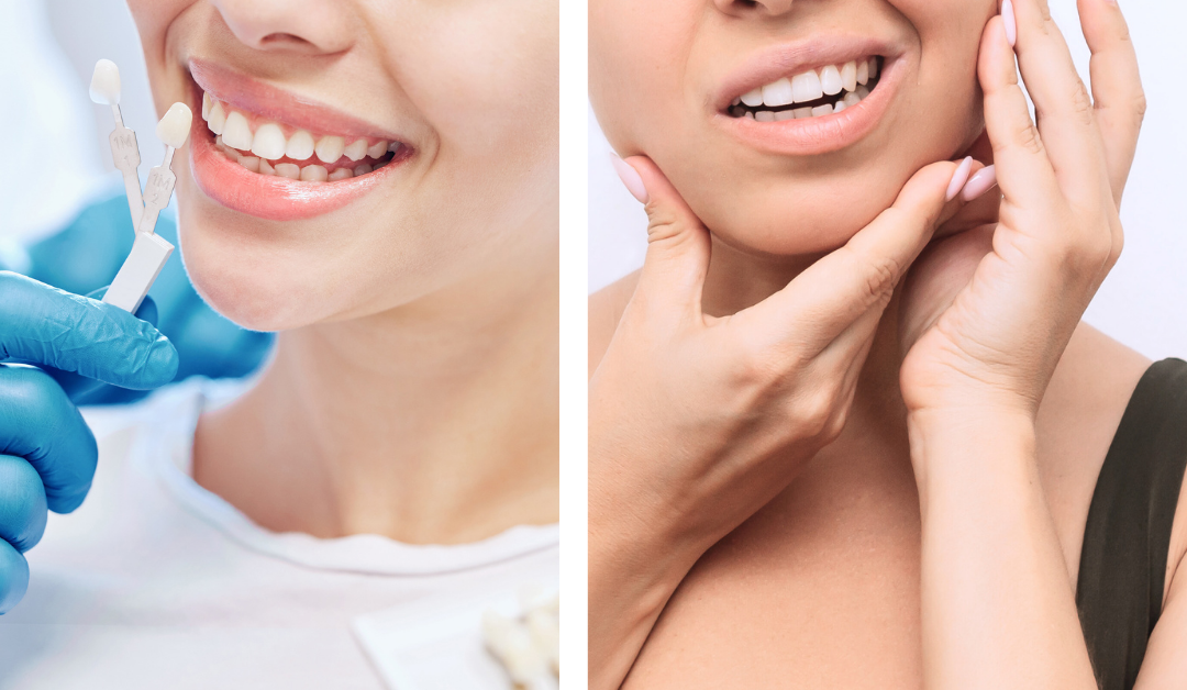 Hidden Dangers Cosmetic Dentistry