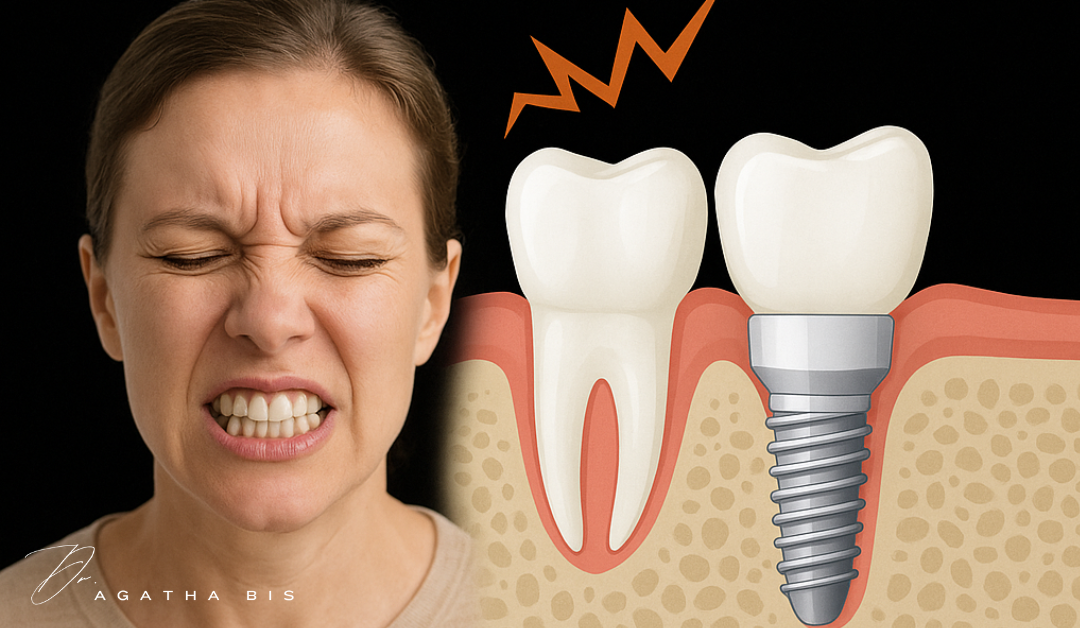 Teeth Grinding and Dental Implants — What You Need to Know