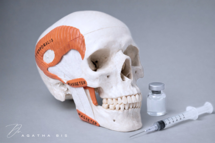 Botox for TMJ in Oakville: When Is It Appropriate?