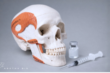 Botox for TMJ in Oakville