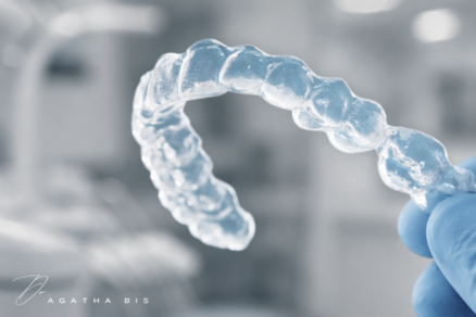 Clear Aligners in Oakville