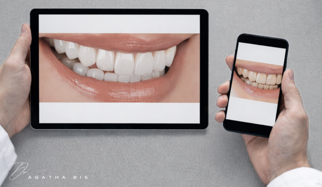 Porcelain Veneers and Bite Stability in Oakville: