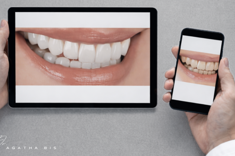 Porcelain Veneers and Bite Stability in Oakville: