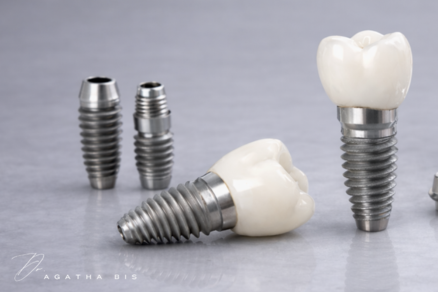Dental Implants Oakville