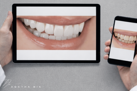 Porcelain Veneers Oakville