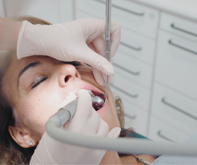 Dental Fillings Oakville the office of Dr. Agatha Bis