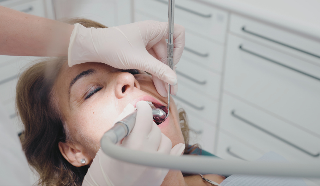 Dental Fillings Oakville Smiles By Bis