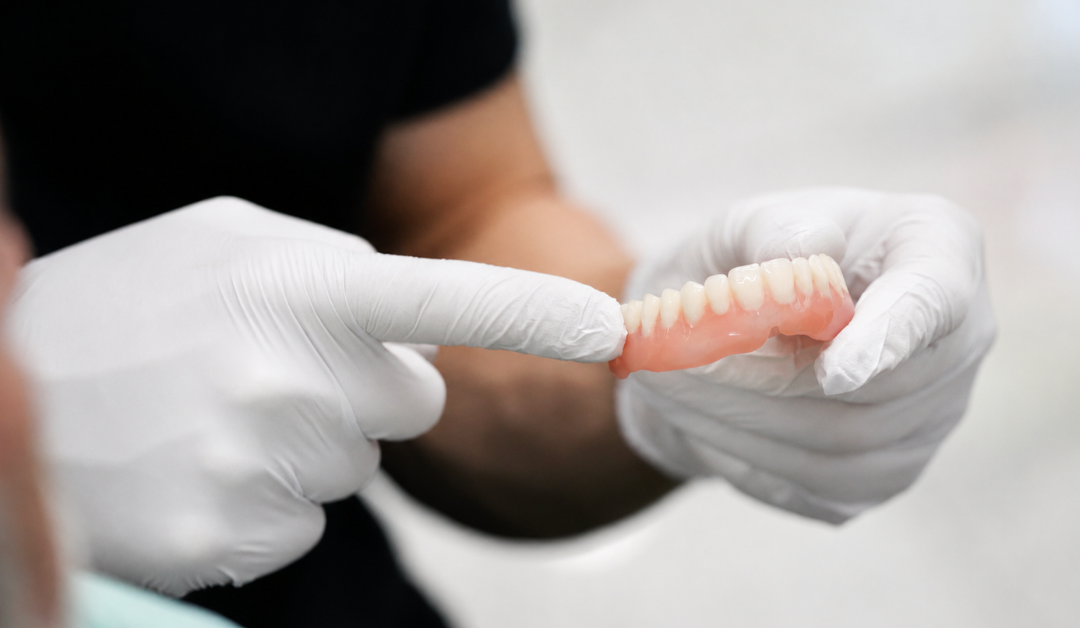 What Are Dentures?