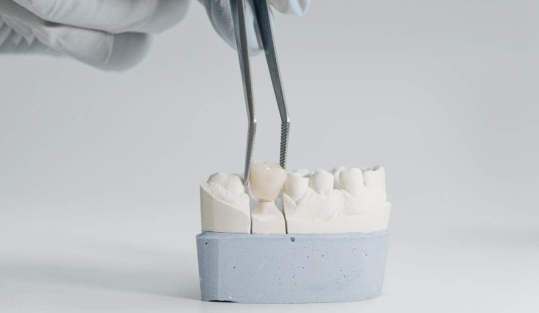 dental crown Oakville
