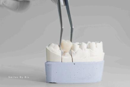 Restorative Dentistry