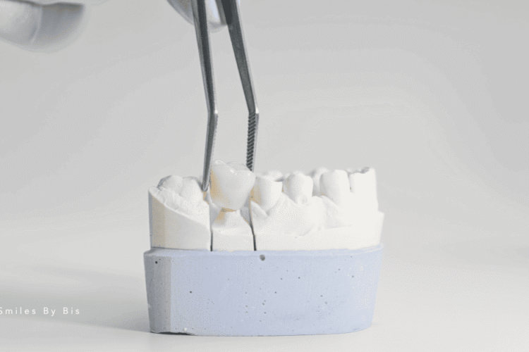 Restorative Dentistry