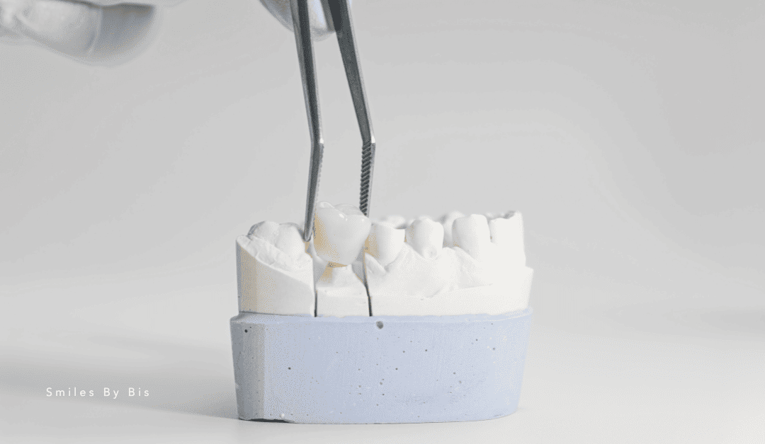 Restorative Dentistry