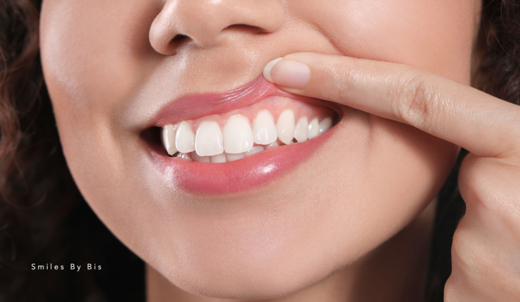 Best Daily Habits for Healthy Gums