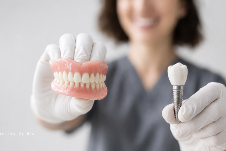 Dentures vs. Dental Implants