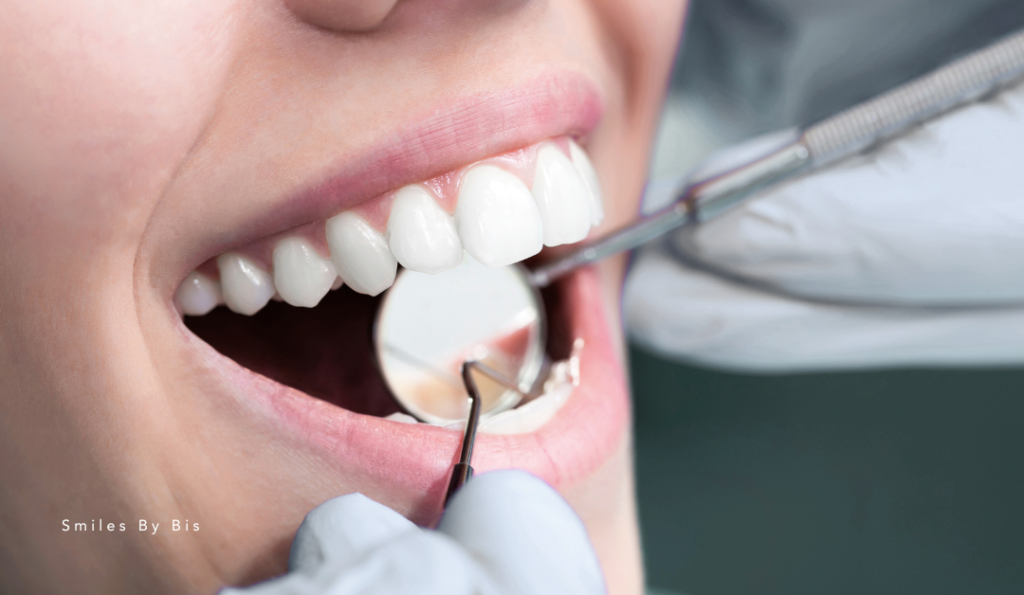 Regular Dental Checkups