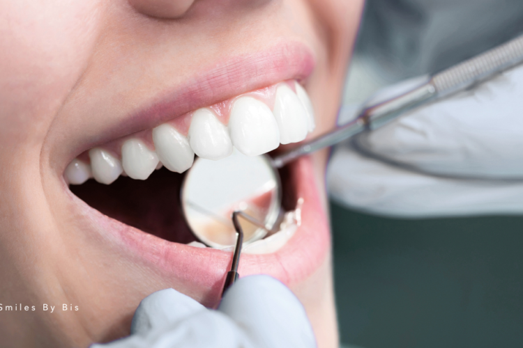 Regular Dental Checkups